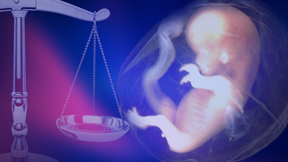 Ohio – Finis les avortements basés sur le diagnostic prénatal de la trisomie 21.