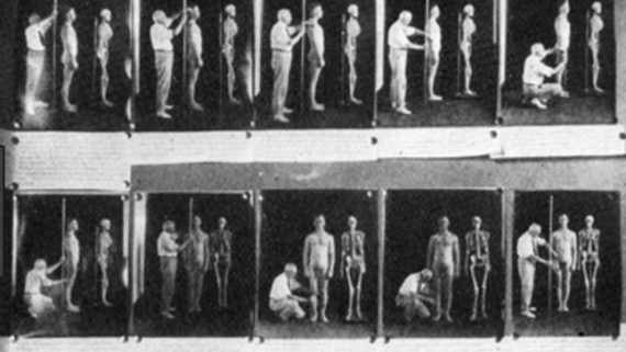 La stérilisation forcée et l’avortement de milliers de personnes au Japon a eu lieu pendant la seconde guerre mondiale